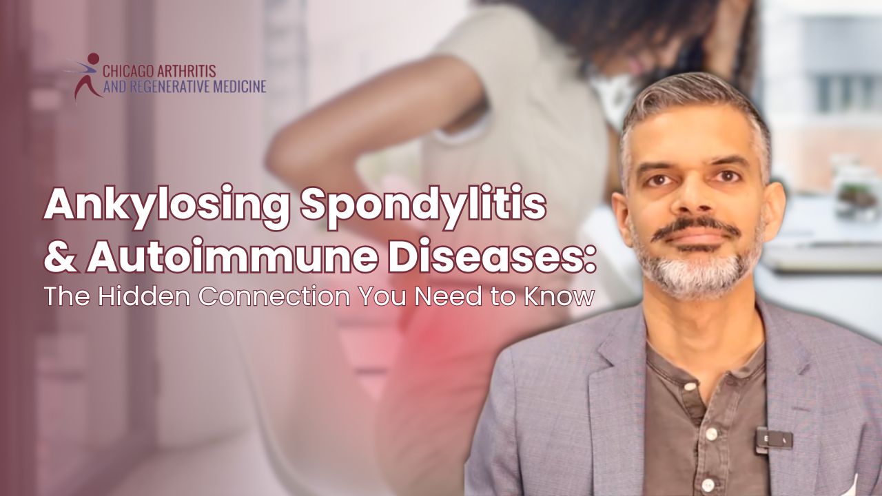 Ankylosing Spondylitis & Autoimmune Diseases: The Hidden Connection You Need to Know