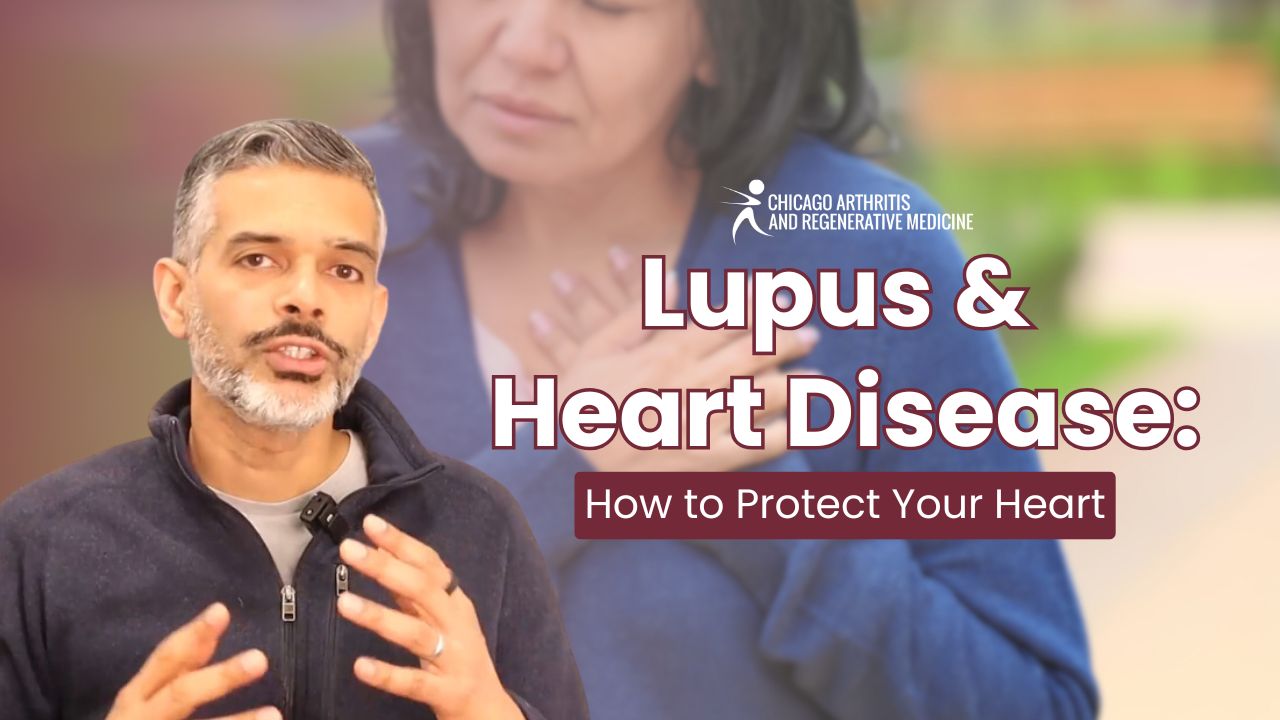 Lupus and Heart Disease: How to Protect Your Heart