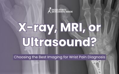 X-ray, MRI, or Ultrasound: Choosing the Best Imaging for Wrist Pain Diagnosis