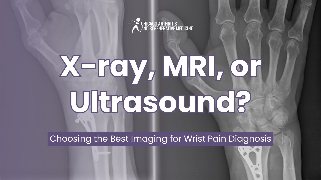 X-ray, MRI, or Ultrasound: Choosing the Best Imaging for Wrist Pain Diagnosis