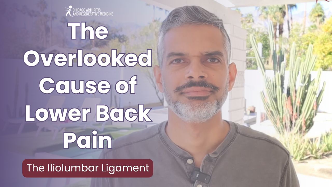 The Overlooked Cause of Lower Back Pain: The Iliolumbar Ligament