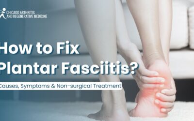 How to Fix Plantar Fasciitis? Causes, Symptoms & Non-surgical Treatment