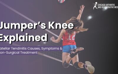Jumper’s Knee Explained: Patellar Tendinitis Causes, Symptoms & Non-Surgical Treatment