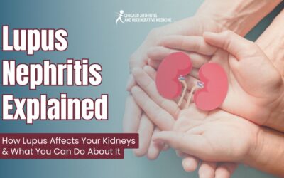 Lupus Nephritis Explained! How Lupus Affects Your Kidneys & What You Can Do About It