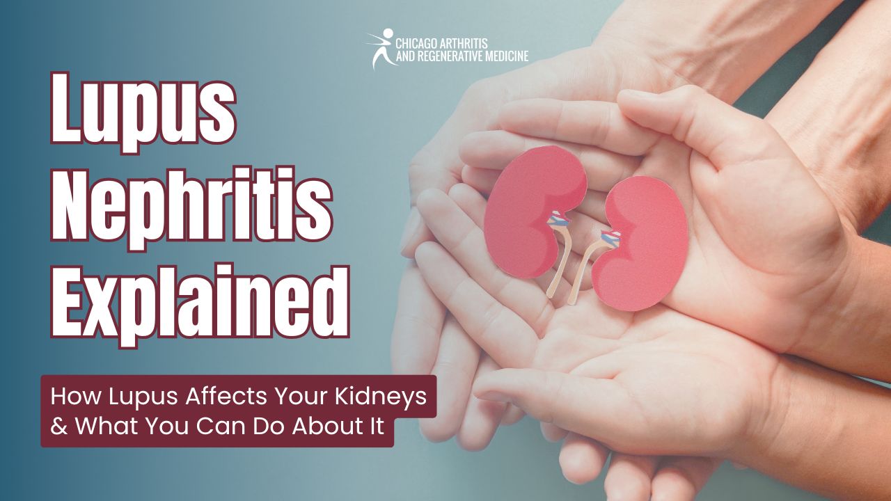 Lupus Nephritis Explained! How Lupus Affects Your Kidneys & What You Can Do About It
