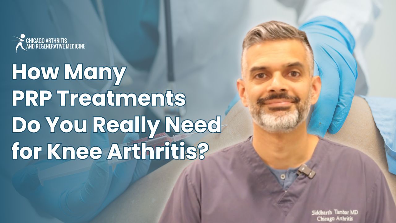 How Many PRP Treatments Do You Really Need for Knee Arthritis?