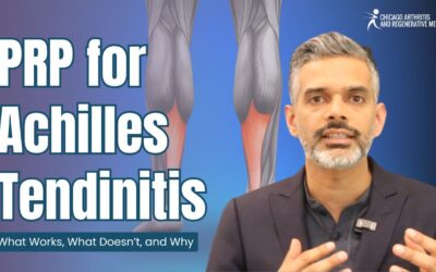 PRP for Achilles Tendinitis: What Works, What Doesn’t, and Why