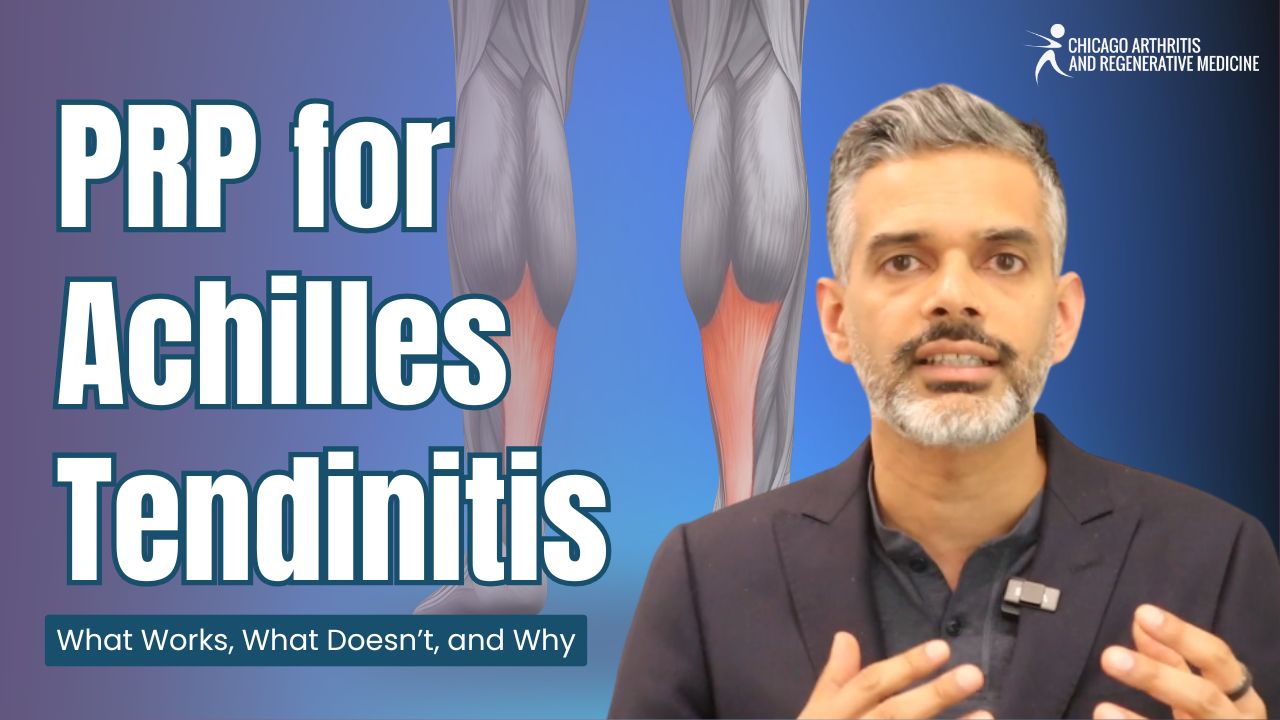 PRP for Achilles Tendinitis: What Works, What Doesn’t, and Why