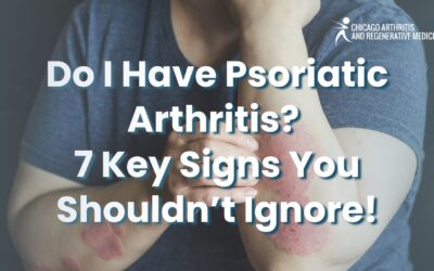 Do I Have Psoriatic Arthritis? 7 Key Signs You Shouldn’t Ignore