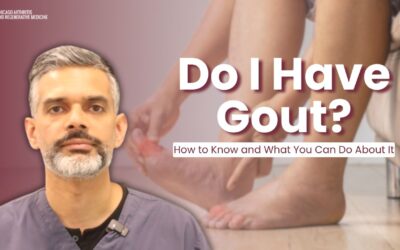 Do I Have Gout? How to Know and What You Can Do About It