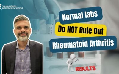 Normal Labs Do NOT Rule Out Rheumatoid Arthritis
