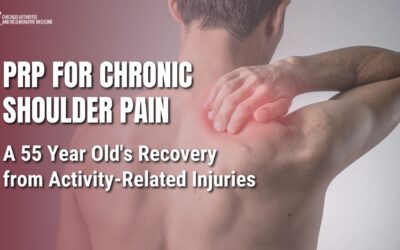 PRP for Chronic Shoulder Pain: A 55 Year Old’s Recovery from Activity‑Related Injuries