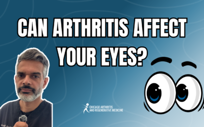 Can Arthritis Affect Your Eyes? Understanding Uveitis and Autoimmune Conditions