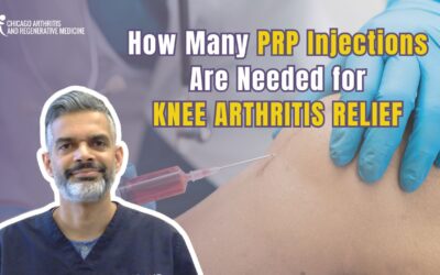 How Many PRP Injections Are Needed for Knee Arthritis Relief?