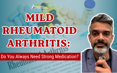 Mild Rheumatoid Arthritis: Do You Always Need Strong Medication?
