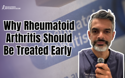 Why Rheumatoid Arthritis Should Be Treated Early
