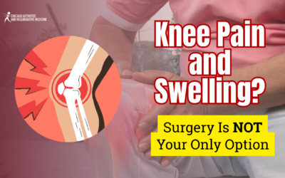 Knee Pain and Swelling? Surgery Isn’t Your Only Option