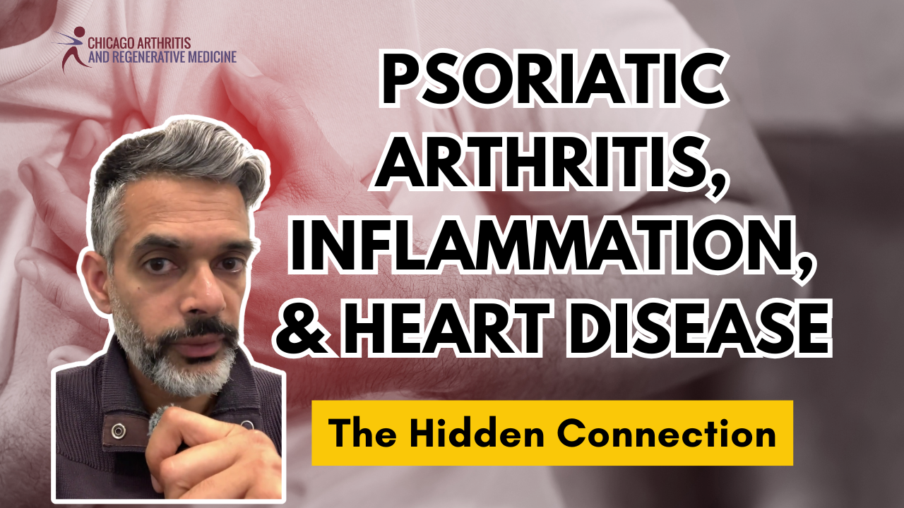 Psoriatic Arthritis, Inflammation, and Heart Disease: The Hidden Connection