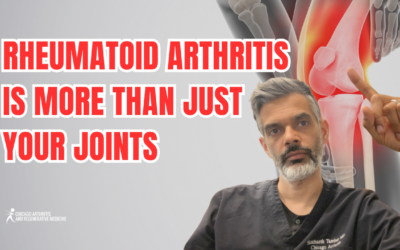 Rheumatoid Arthritis Is More Than Just Your Joints