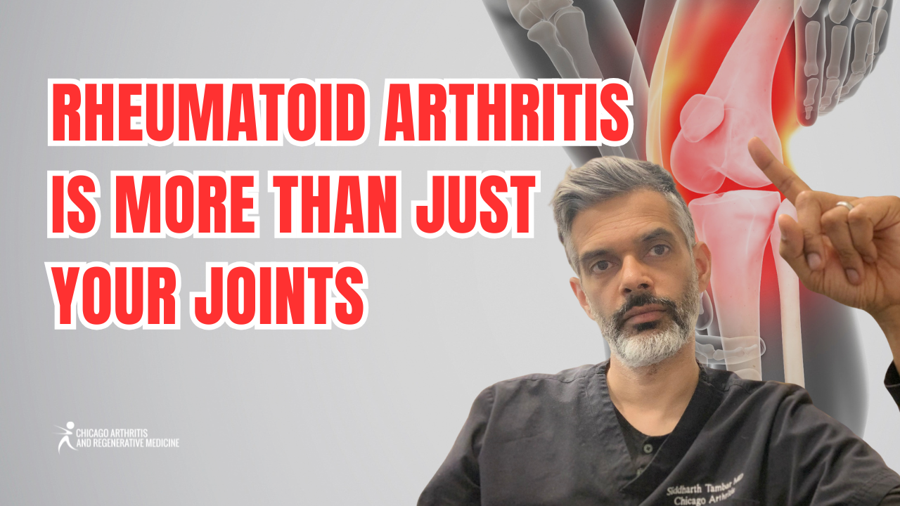 Rheumatoid Arthritis Is More Than Just Your Joints
