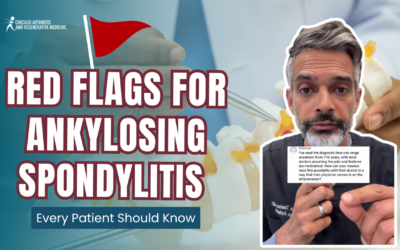 Red Flags for Ankylosing Spondylitis Every Patient Should Know