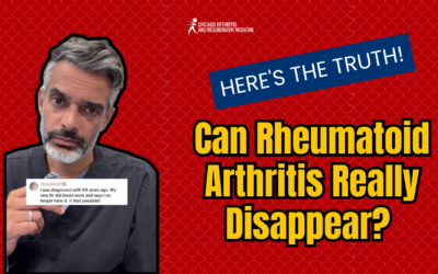 Can Rheumatoid Arthritis Really Disappear? Here’s the Truth