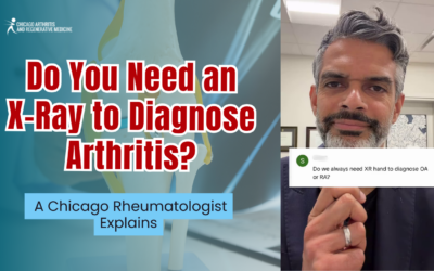 Do You Need an X-Ray to Diagnose Arthritis? A Chicago Rheumatologist Explains