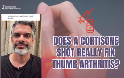 Does a Cortisone Shot Really Fix Thumb Arthritis?