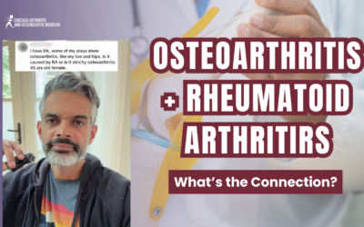 Osteoarthritis + RA: What’s the Connection?