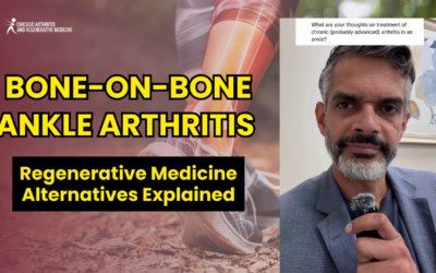 Bone-on-Bone Ankle Arthritis: Regenerative Medicine Alternatives Explained