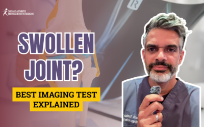 Swollen Joint? Best Imaging Test Explained