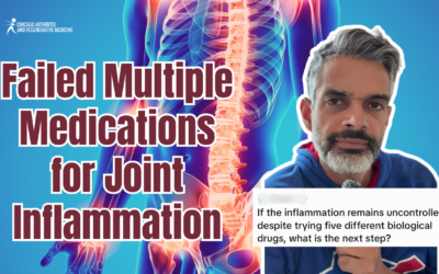 Failed Multiple Medications for Joint Inflammation