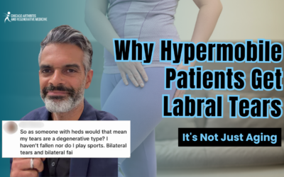 Why Hypermobile Patients Get Labral Tears (It’s Not Just Aging)
