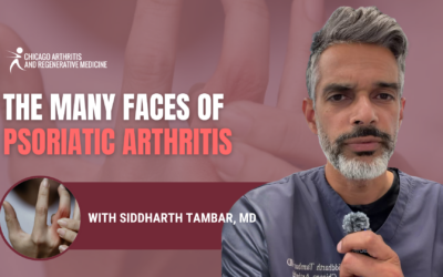 Psoriatic Arthritis Symptoms & Treatment in Chicago: 7 Ways PsA Can Show Up