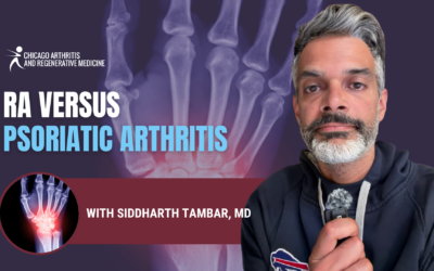 Rheumatoid Arthritis vs. Psoriatic Arthritis: A Chicago Rheumatologist Explains the Difference
