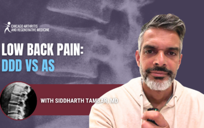 Degenerative Disc Disease vs. Ankylosing Spondylitis: How They Differ and How They’re Treated
