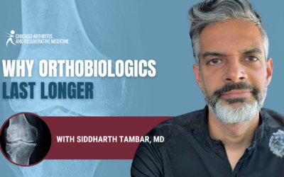 Orthobiologic Treatments vs. Steroid Injections: Lasting Joint Pain Relief From a Chicago Rheumatologist