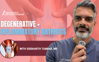 Inflammatory and Degenerative Arthritis: Why You Need a Plan for Both