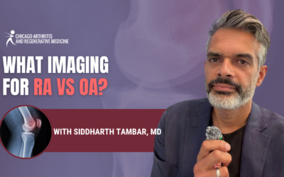 Rheumatoid Arthritis vs. Osteoarthritis: Which Imaging Test Gives the Clearest Answer?