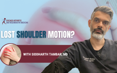 Losing Shoulder Range of Motion? Why Your X-Ray May Not Tell the Whole Story