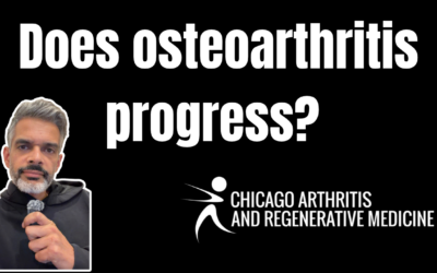 Does Osteoarthritis Progress When Pain is Controlled?